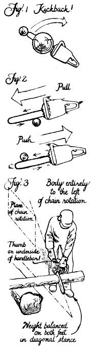 
Kickback is the most common cause of wounds. It causes 30% of all chain saw injuries.
